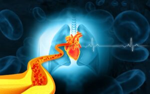 cholesterol - hladina tuku v krvi