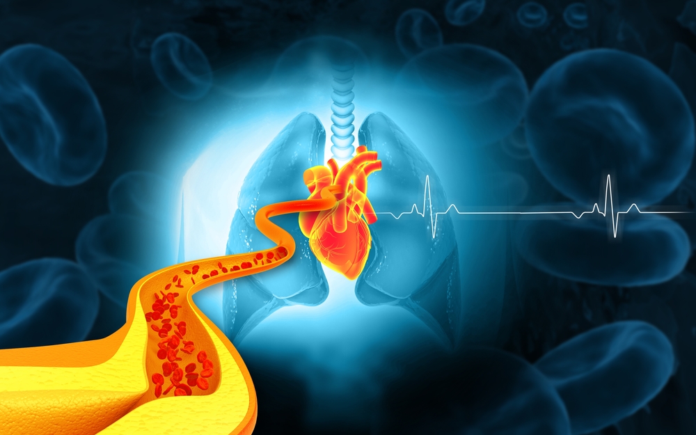 cholesterol - hladina tuku v krvi
